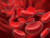 anémia, chudokrvnosť, celiakia, železo, hemochromatóza, červené krvinky, krv, hemoglobín
