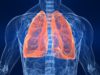 astma, priedušky, pľúca, cysty, dýchací, tráviaci systém, hlien, zápal